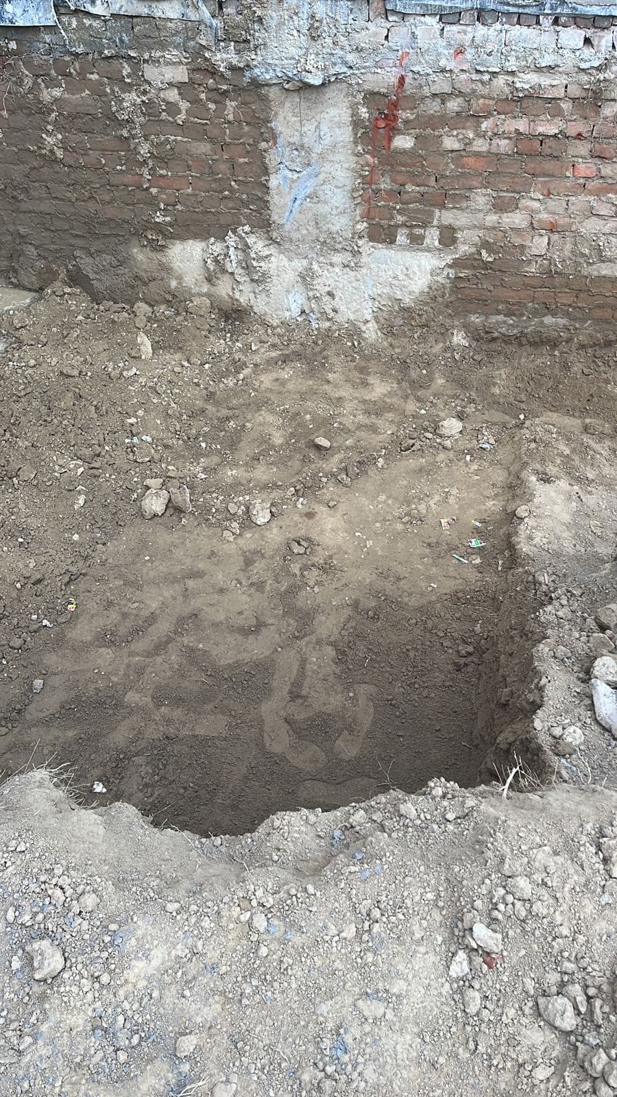 Excavation & Dressing